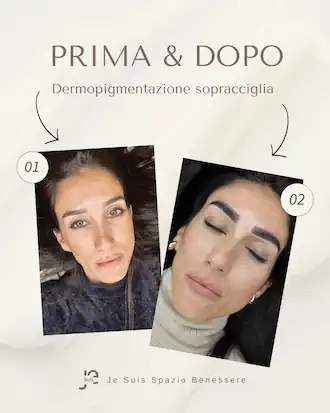 Dermopigmentazione 3
